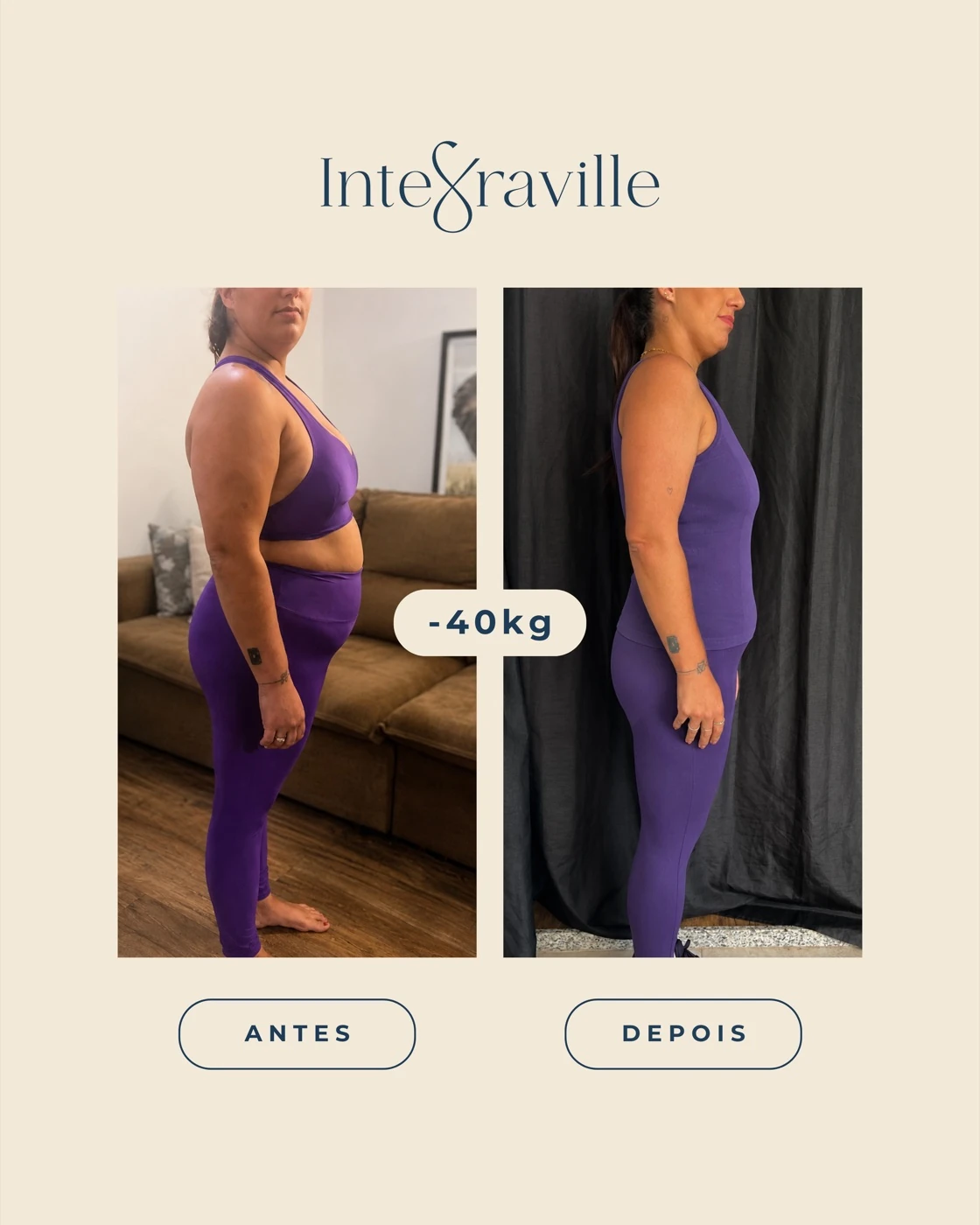 Antes e depois de paciente IntegraVille com redução de 40kg