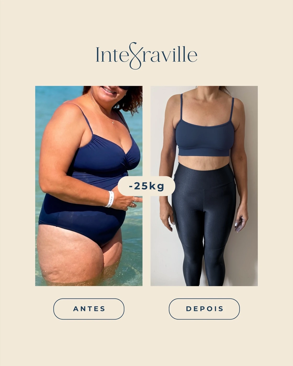 Antes e depois de paciente IntegraVille