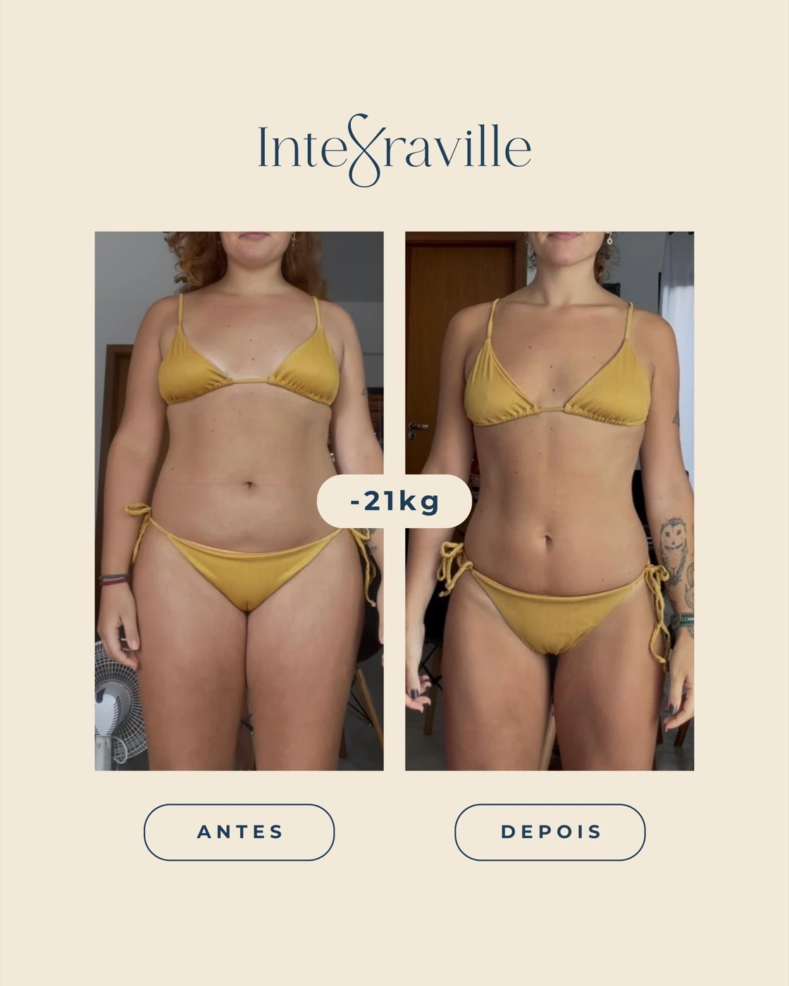Antes e depois de paciente IntegraVille