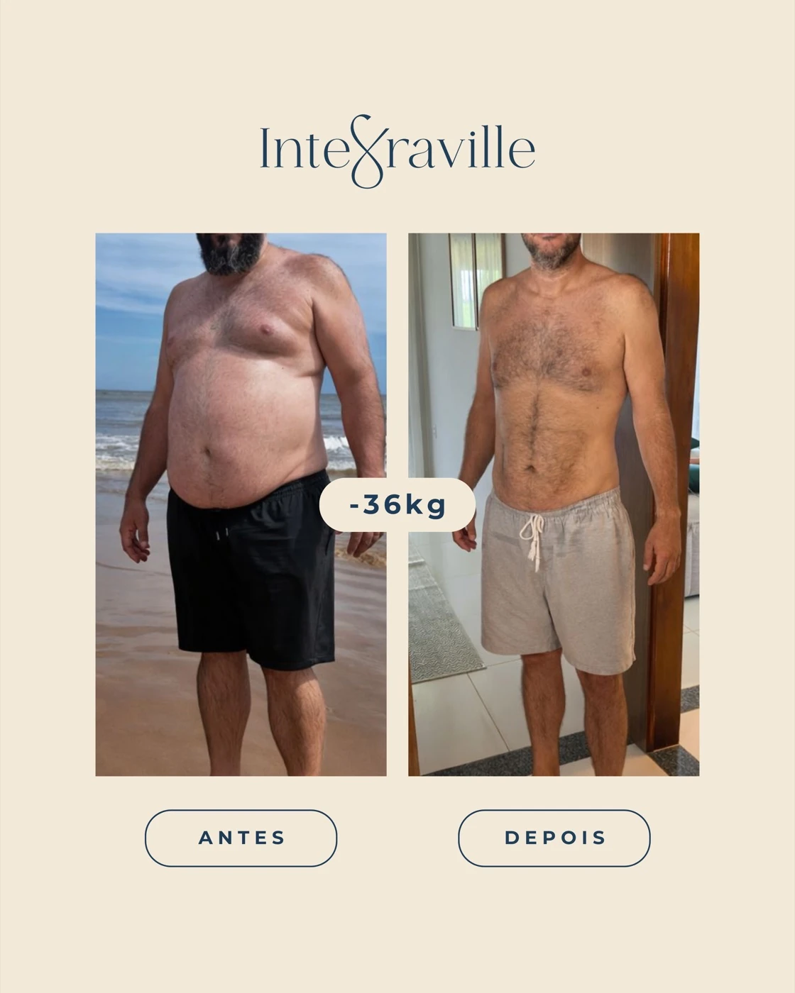 Antes e depois de paciente IntegraVille